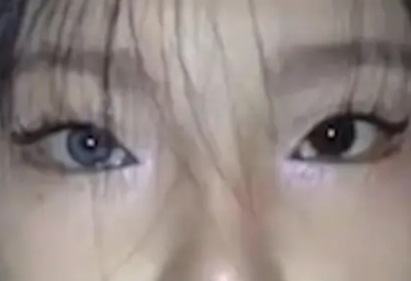 长沙18岁高三女孩右眼天生蓝瞳 被人羡慕